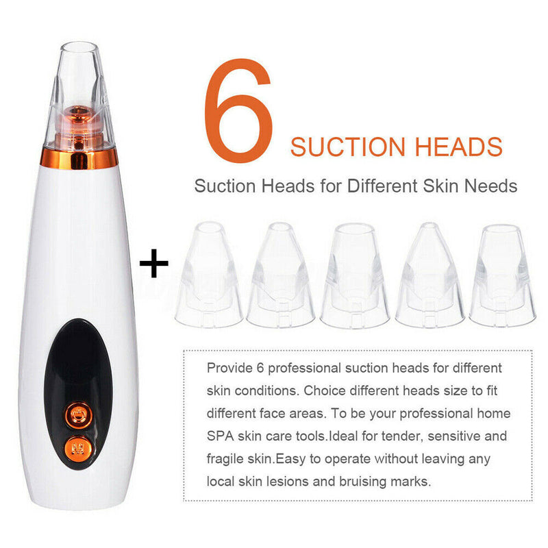 Free shipping-6 in 1 Electric Facial Blackhead Remover